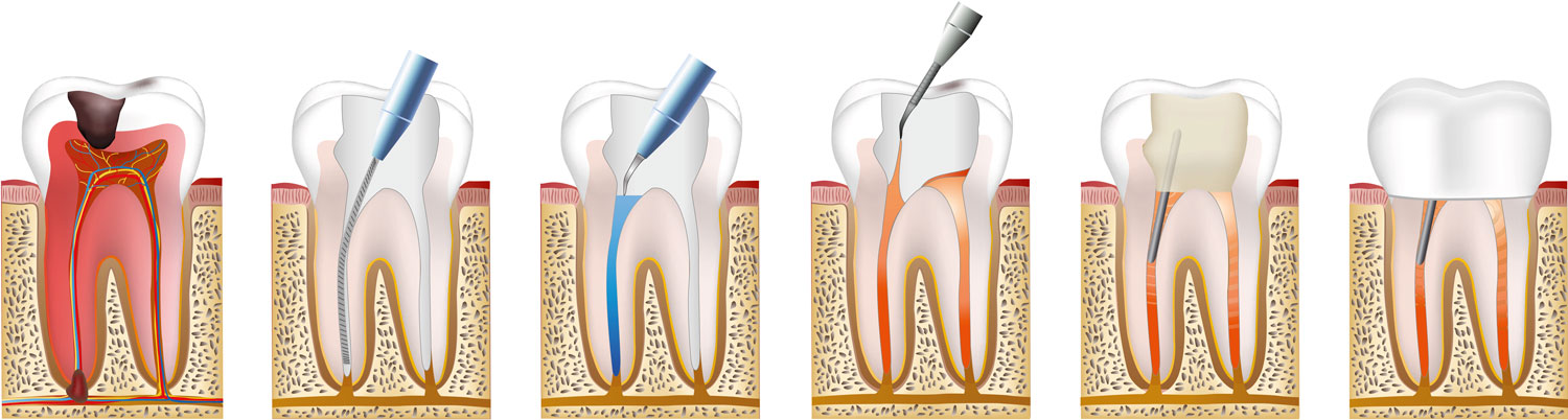 Endodontie